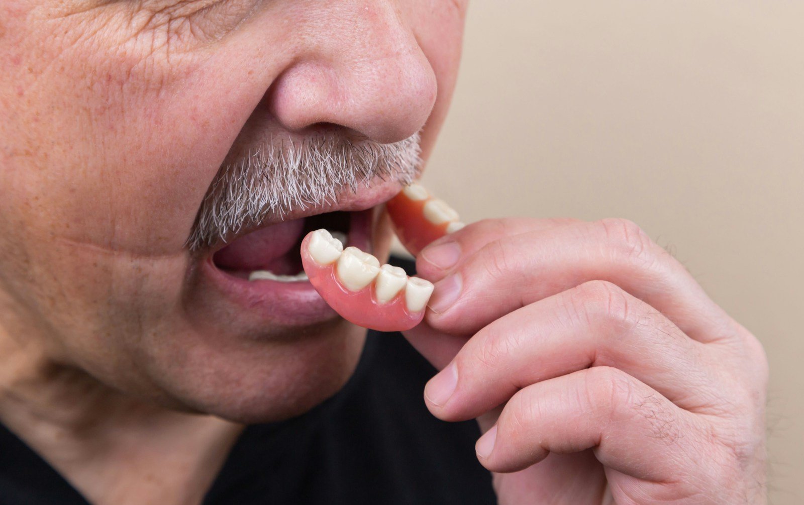 Does Medicare Cover Dental? A Georgia Senior’s Guide